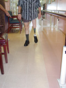 Ambulation exhibited with excellent balance and control on sound limb. - Garrison's Prosthetic Services