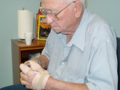Patient is left alone to test the function of the prosthetic fingers. - Garrison's Prosthetic Services
